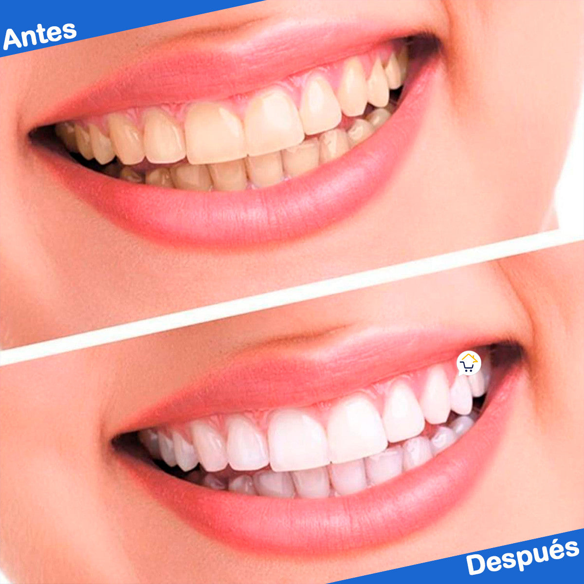 OFERTA 2 x 1 - Tiras Blanqueadoras Dentales